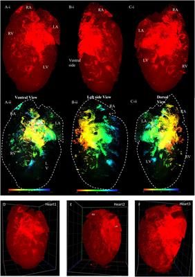 High-Resolution 3D Heart Models of Cardiomyocyte Subpopulations in Cleared Murine Heart